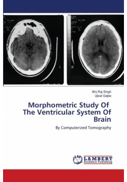 Morphometric Study Of The Ventricular System Of Brain