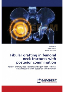Fibular grafting in femoral neck fractures with posterior comminution