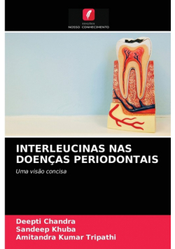 Interleucinas Nas Doenças Periodontais