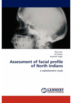 Assessment of facial profile of North Indians