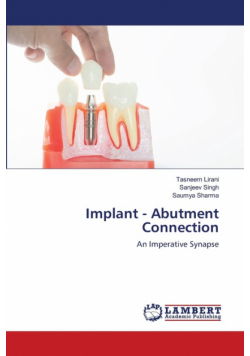 Implant - Abutment Connection