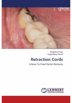 Retraction Cords