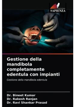 Gestione della mandibola completamente edentula con impianti