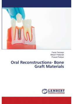 Oral Reconstructions- Bone Graft Materials