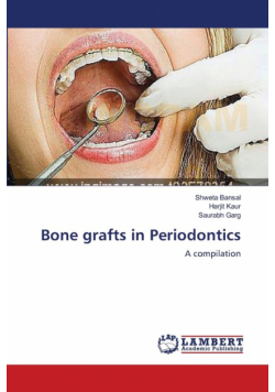 Bone grafts in Periodontics