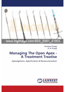 Managing The Open Apex - A Treatment Treatise