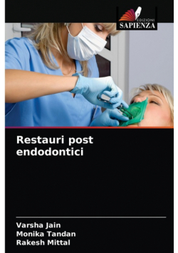 Restauri post endodontici
