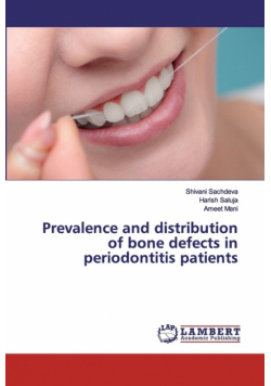 Prevalence and distribution of bone defects in periodontitis patients