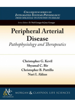 Peripheral Arterial Disease