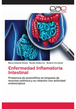 Enfermedad Inflamatoria Intestinal