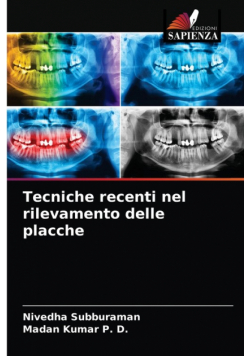 Tecniche recenti nel rilevamento delle placche