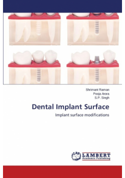 Dental Implant Surface