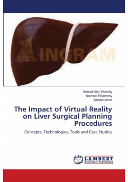 The Impact of Virtual Reality on Liver Surgical Planning Procedures