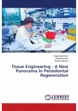 Tissue Engineering - A New Panorama In Periodontal Regeneration