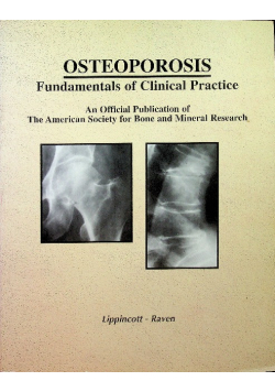 Osteoporosis fundamentals of clinical practice