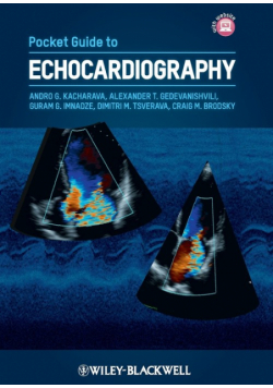 Pocket Guide to Echocardiograp