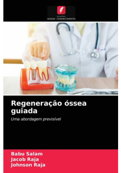 Regeneração óssea guiada