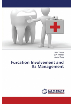 Furcation Involvement and Its Management