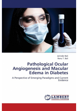 Pathological Ocular Angiogenesis and Macular Edema in Diabetes