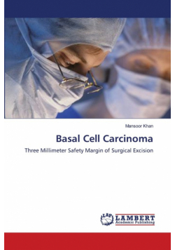 Basal Cell Carcinoma