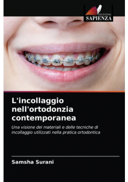 L'incollaggio nell'ortodonzia contemporanea