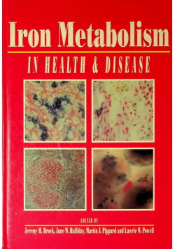 Iron Metabolism in health disease
