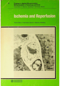 Ischemia and Reperfusion