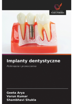 Implanty dentystyczne