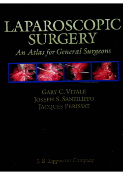 Laparoscopic surgery