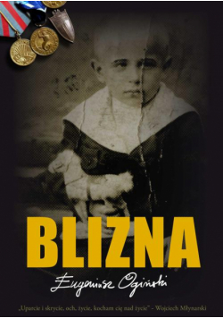 Blizna