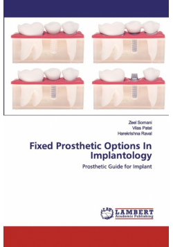 Fixed Prosthetic Options In Implantology