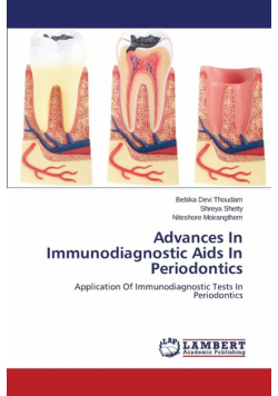 Advances In Immunodiagnostic Aids In Periodontics