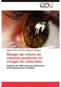 Riesgo de Rotura de Capsula Posterior En Cirugia de Cataratas