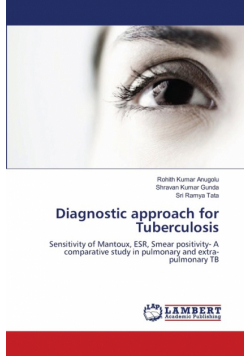 Diagnostic approach for Tuberculosis