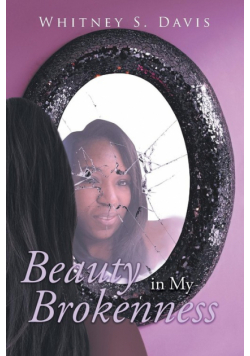 Beauty in My Brokenness