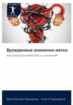 Врожденные аномалии матки