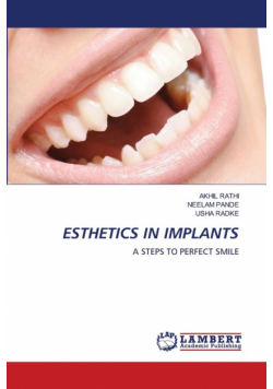 Esthetics In Implants