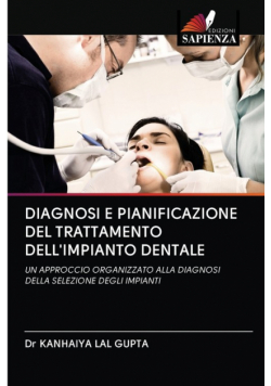 Diagnosi E Pianificazione Del Trattamento Dell'impianto Dentale