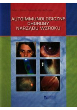 Autoimmunologiczne choroby narządu wzroku