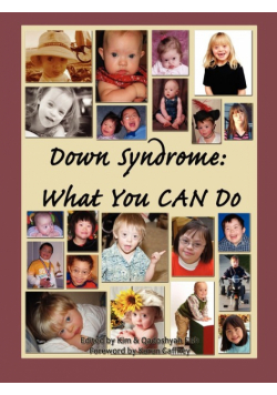 Down Syndrome