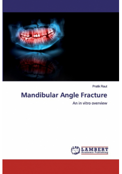Mandibular Angle Fracture