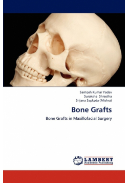 Bone Grafts