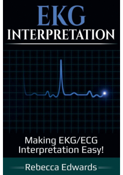EKG Interpretation