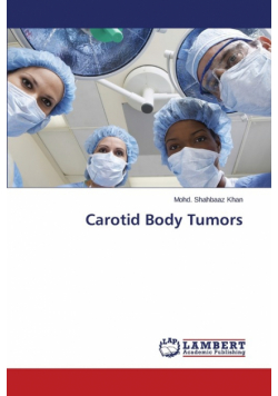 Carotid Body Tumors