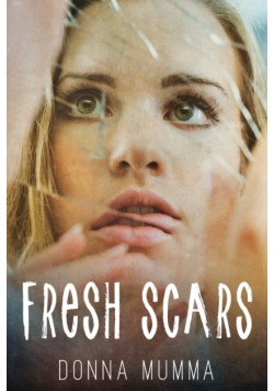 Fresh Scars
