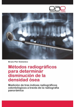 Métodos radiográficos para determinar disminución de la densidad ósea