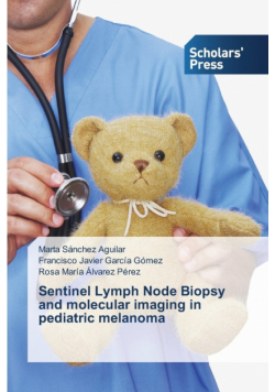 Sentinel Lymph Node Biopsy and molecular imaging in pediatric melanoma