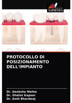 Protocollo Di Posizionamento Dell'impianto