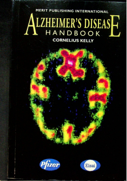 Alzmeimers Disease