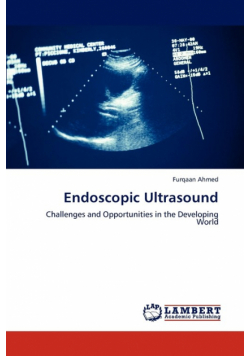 Endoscopic Ultrasound